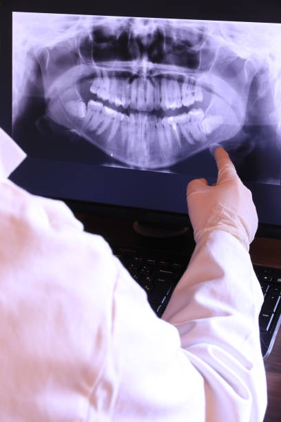 Urgent Tooth Repair in WA